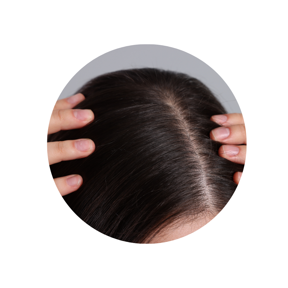 Oberkop pigmentieren