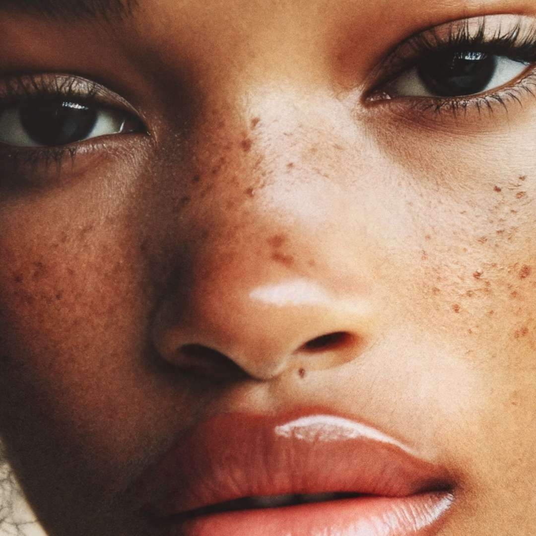 PMU Freckles Behandlung inkl. Nachbehandlung | Sommersprossen